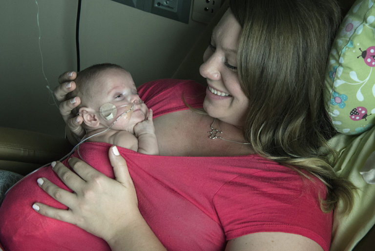 AAP: Kangaroo Care Lowers Risk of Death in Preemies