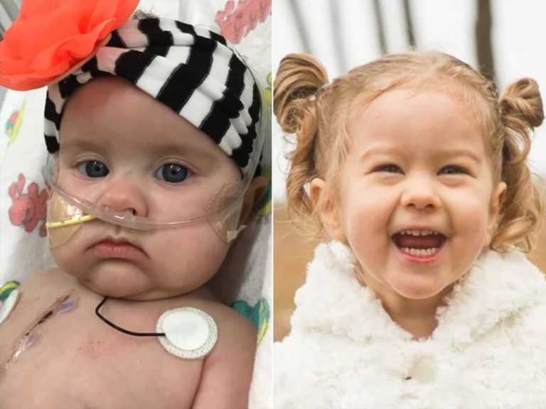 Toddler Thriving After Getting World\’s Tiniest Heart Valve as Infant: We Knew \’She Could Die\’